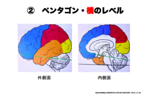 ペンタゴン・延髄のレベル　脳画像の見方　