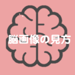 Vol.190 リハビリテーション分野における脳画像のみかた③