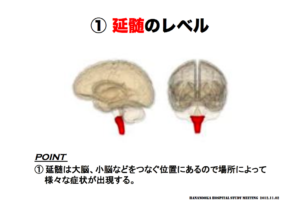 延髄のレベル　脳画像の見方