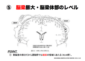 脳梁膨大・脳梁体部のレベル　顔面の領域