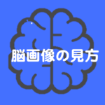 Vol.189　リハビリテーション分野における脳画像のみかた②　