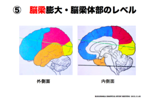 脳梁膨大・脳梁体部の見方　脳