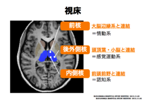 視床の見方