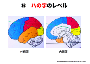 八の字のレベル　脳画像の見方