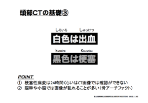 頭部CTの基礎　脳画像の見方　白色と黒色の違い