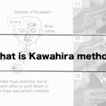Vol.388　What is Kawahira methods（repetitive facilitation exercises）?