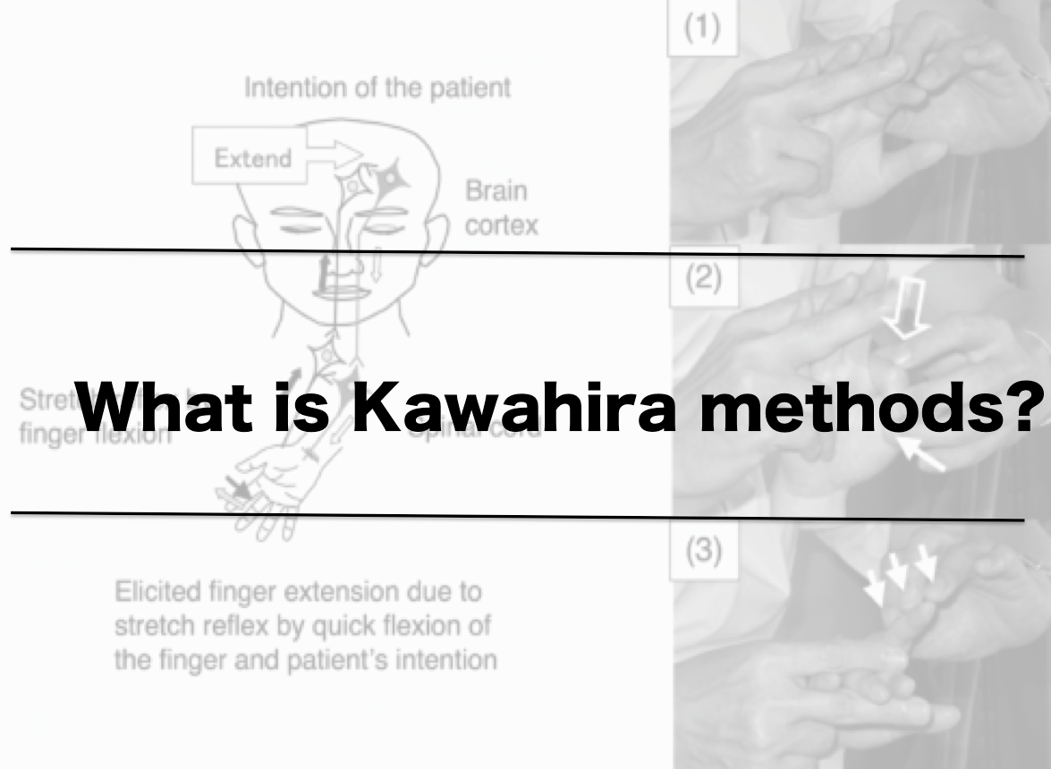 Vol.388　What is Kawahira methods（repetitive facilitation exercises）?