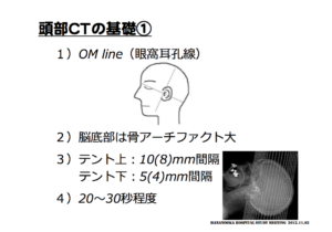 頭部CTの基礎　脳画像の見方