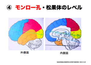 モンロー孔・松果体のレベル　脳画像の見方　