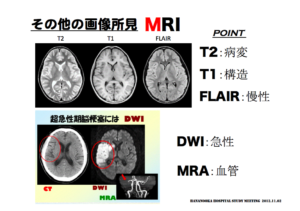 MRIの見方　脳画像の見方　T2とT1