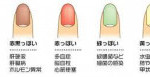Vol.74　Color of fingernail