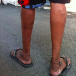 Vol.310 高齢化によって増えるサルコペニア　 タイで働く理学療法士