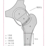 Vol.48　大腿骨頸部、転子部骨折の分類・術式