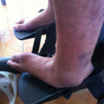 Vol.264　途上国にリハビリ道具を届けませんか？　タイで働く理学療法士